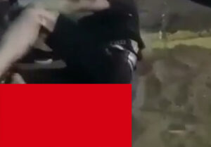 【閲覧注意】バイクで重大事故を起こした人間、右脚が骨だけになってしまう・・・