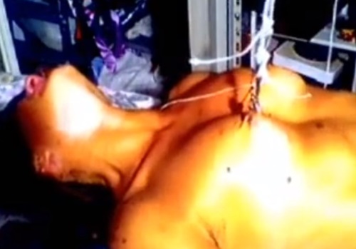 【閲覧注意】乳首を針で貫通させて上に引っ張り上げる残虐拷問動画