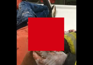 【超閲覧注意】コロンビアのデモ隊の男、慣れない手榴弾を使おうとした結果”こうなる”・・・