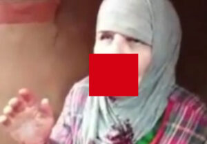 【閲覧注意】銃で撃たれた女性、顔面に大きな穴が開いてしまう・・・(動画あり)