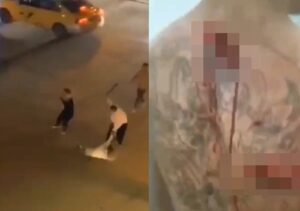 【閲覧注意】ケンカで青龍刀を使った中国人、とんでもない傷を負ってしまう・・・