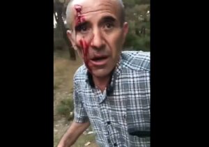 【閲覧注意】犬を獣姦した男、飼い主に見つかりボコボコにされる