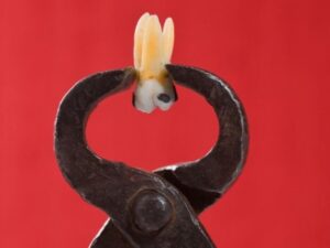 【閲覧注意】ペンチで歯を引っこ抜くギャング拷問、シンプルだけど地獄すぎる…（動画あり）