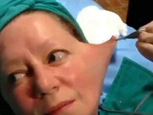 【閲覧注意】美容整形中の女性の手術動画。顔面の皮をベローン。（動画あり）