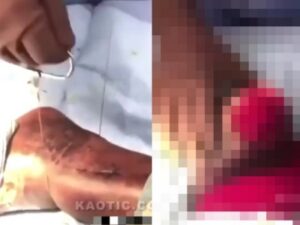 【閲覧注意】ワイヤーソーで人間の足首を切断する動画が流出。相当グロいと話題に・・・